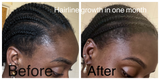 Hair growth oil